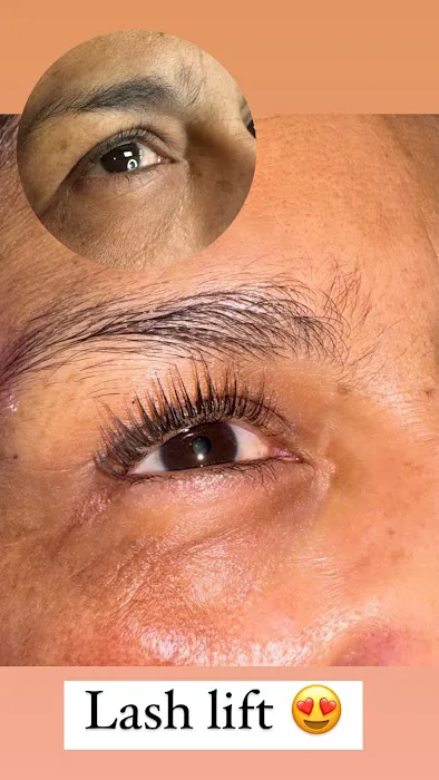 Bellskin Aesthetics Picture 10