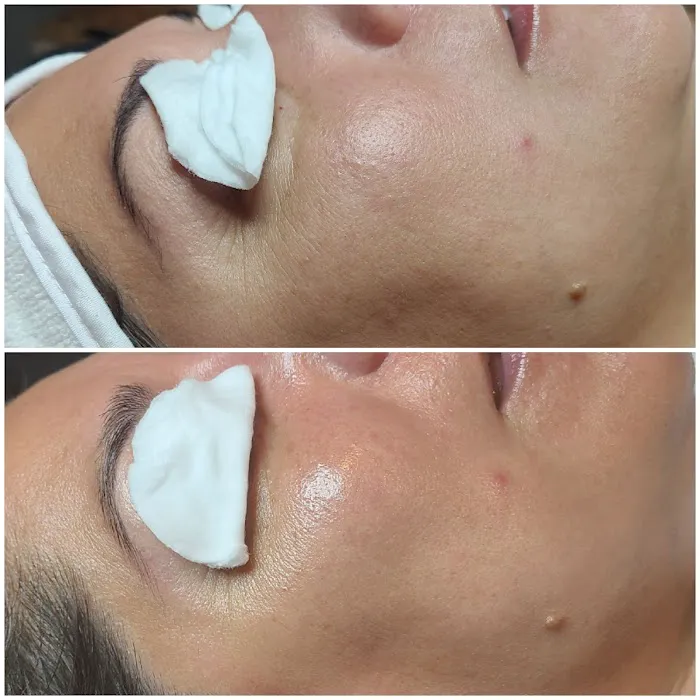 Bella Glow Skin & Body Located Inside The Dominion Suites Picture 8