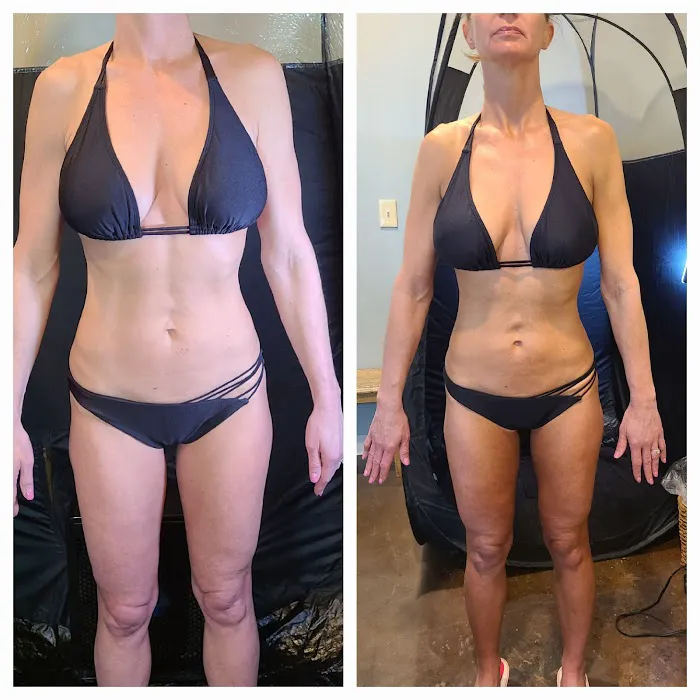 Bella Glow Skin & Body Located Inside The Dominion Suites Picture 3