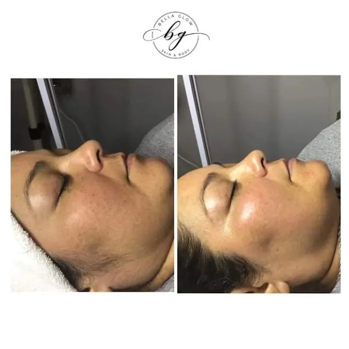 Bella Glow Skin & Body Located Inside The Dominion Suites Picture 10