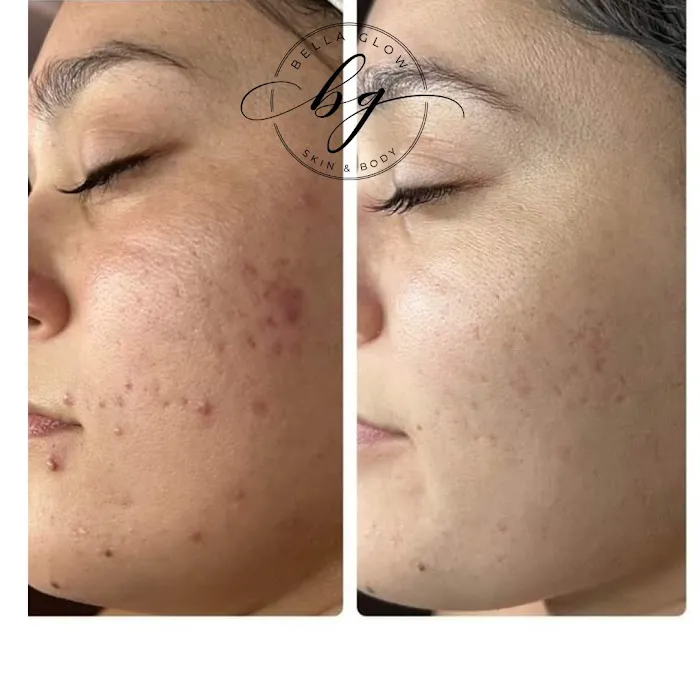 Bella Glow Skin & Body Located Inside The Dominion Suites Picture 6