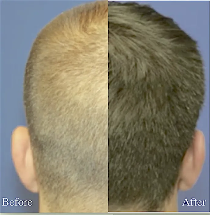 Texas Institute of Dermatology, Laser and Cosmetic Surgery Picture 5