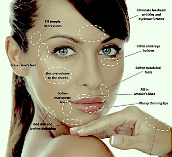 Texas Institute of Dermatology, Laser and Cosmetic Surgery Picture 10