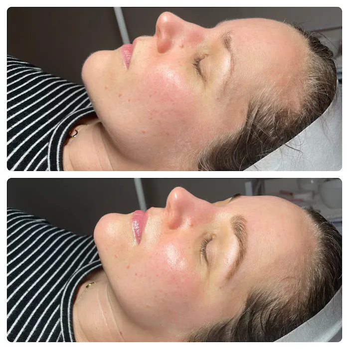 Reverie Esthetics LLC Picture 8