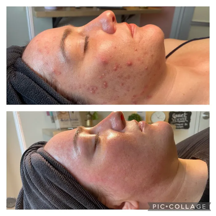 Complexion Skin Studio Picture 4