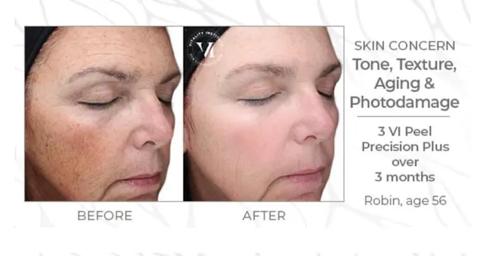 About Face Aesthetics Picture 1