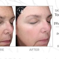 About Face Aesthetics ico