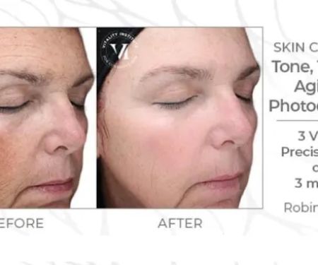 About Face Aesthetics