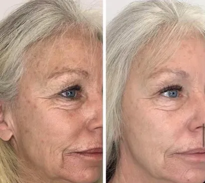 About Face Aesthetics Picture 8