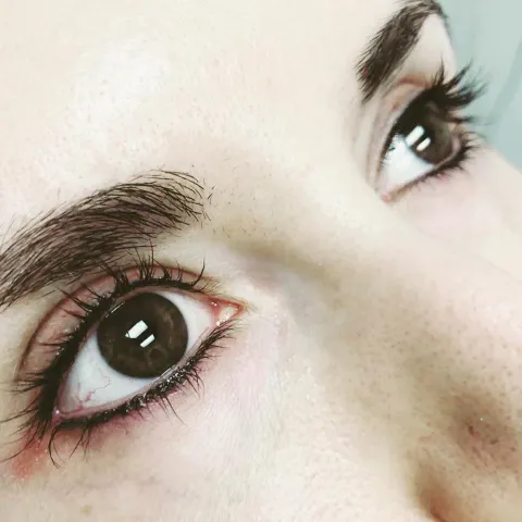 About Face Aesthetics Picture 7