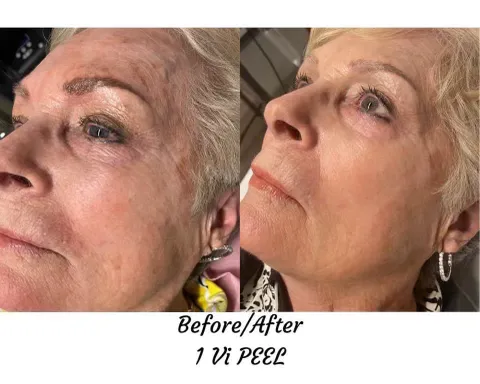 About Face Aesthetics Picture 6