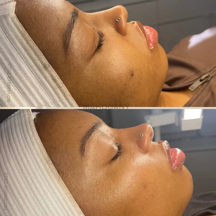 Mahogany Skin Picture 5