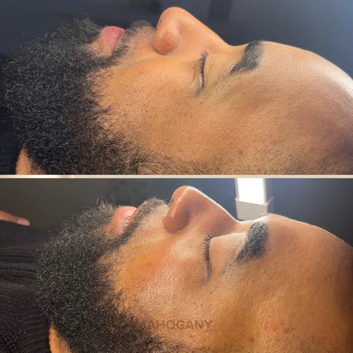 Mahogany Skin Picture 2