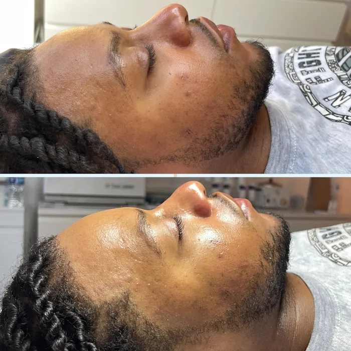 Mahogany Skin Picture 4