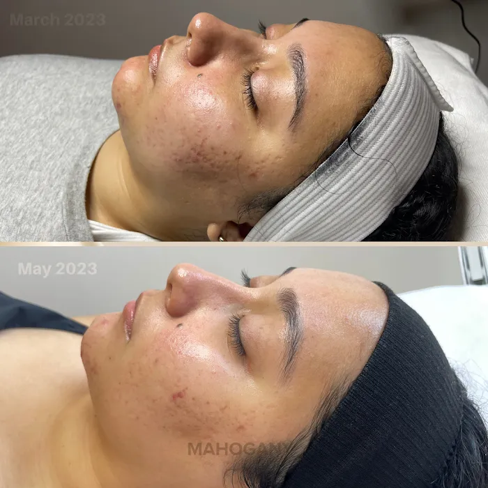 Mahogany Skin Picture 3