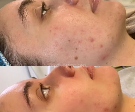 Skin Devotion's By Dana Marie