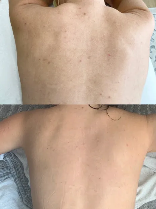 The Peel Connection - Chemical peels Picture 1