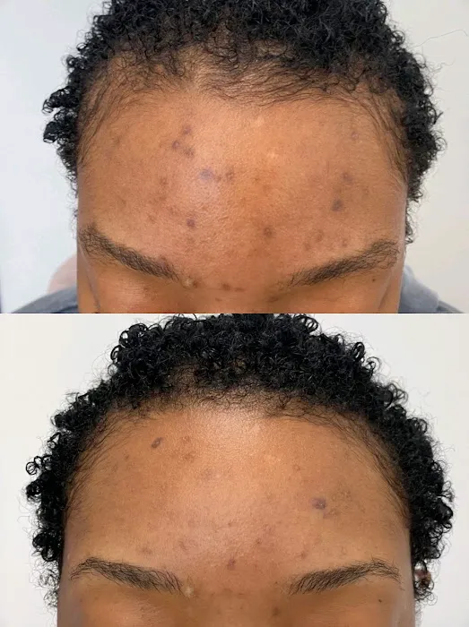 The Peel Connection - Chemical peels Picture 5