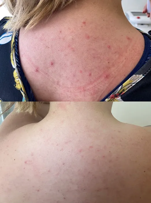 The Peel Connection - Chemical peels Picture 8