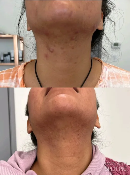 The Peel Connection - Chemical peels Picture 9