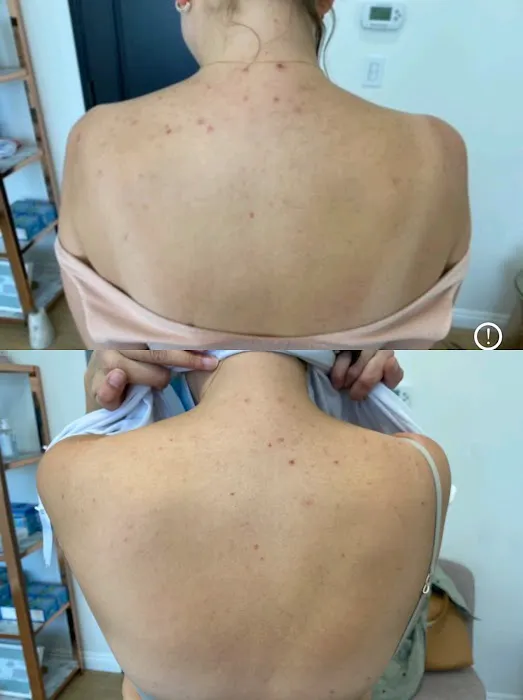 The Peel Connection - Chemical peels Picture 7