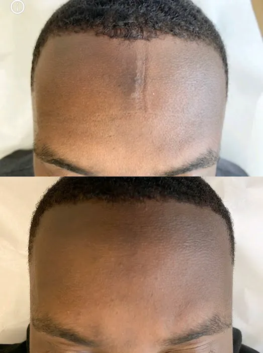 The Peel Connection - Chemical peels Picture 4