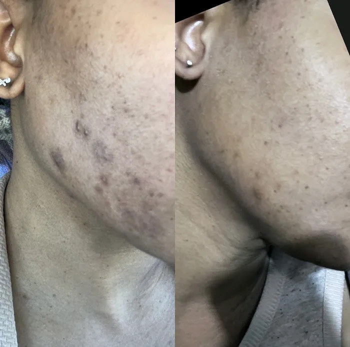 The Peel Connection - Chemical peels Picture 6