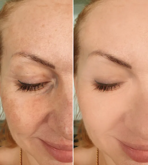 The Skin Division Picture 3