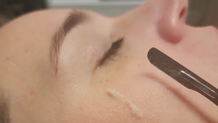 The Skin Division Picture 10