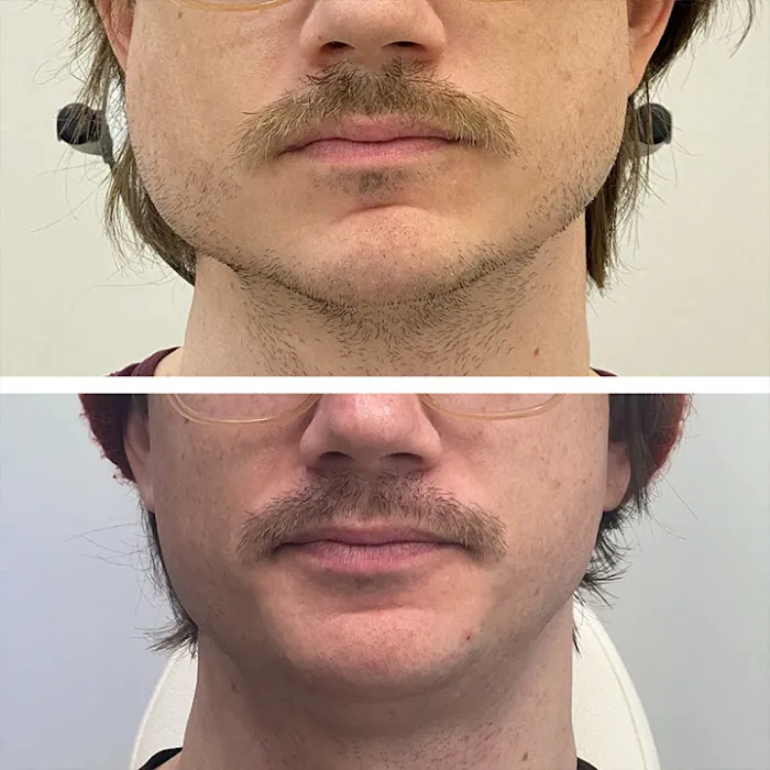 Aesthetic Skin Chicago Picture 2