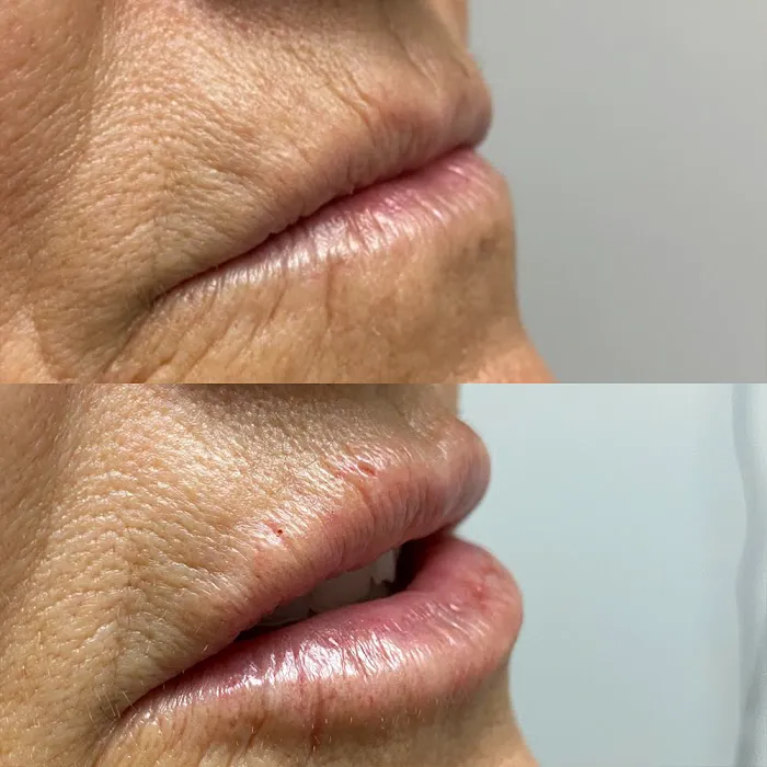 Aesthetic Skin Chicago Picture 6