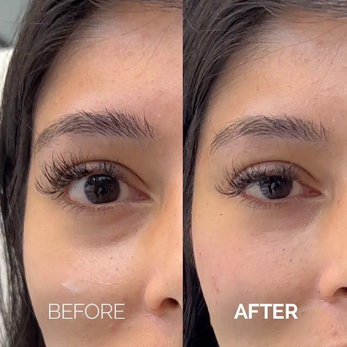 Aesthetic Skin Chicago Picture 5