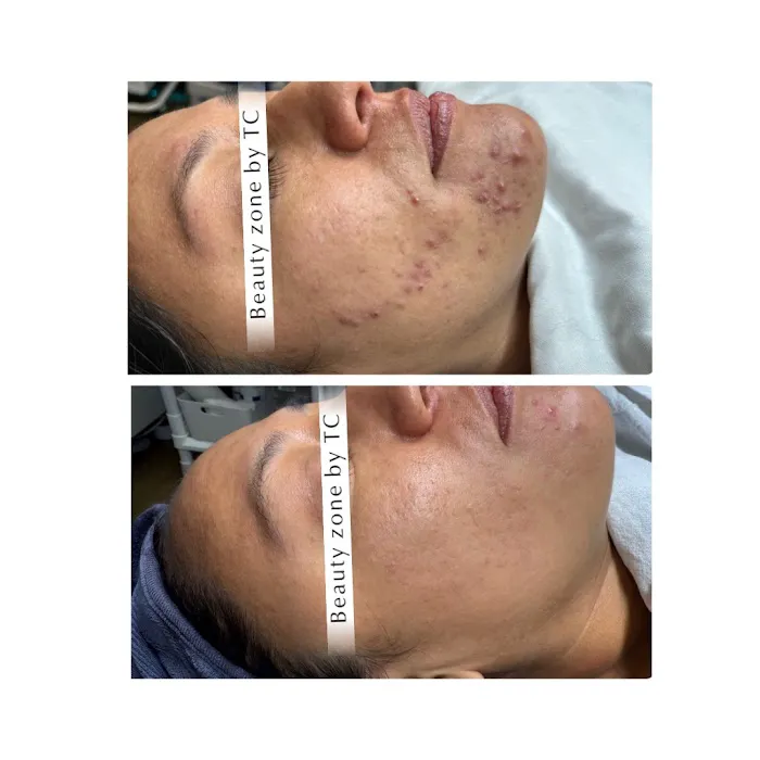 Beauty zone by Tetiana Cherepaka Picture 9