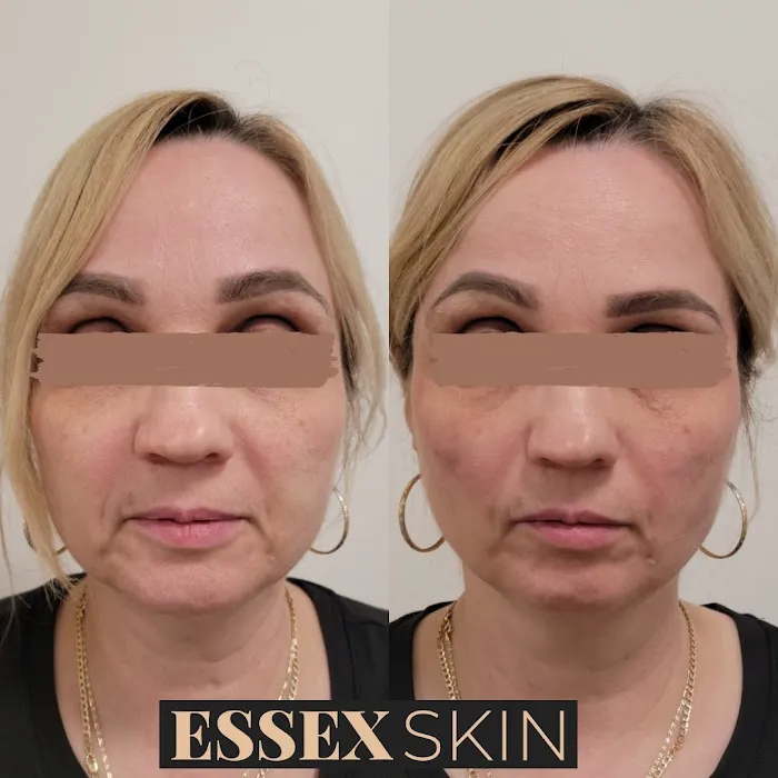 Essex Skin Medical Aesthetics Picture 2