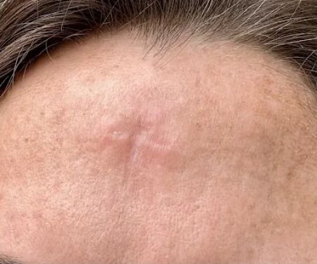 Dermatology + Aesthetics - Bucktown