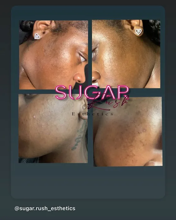 Sugar Rush Esthetics LLC Picture 2
