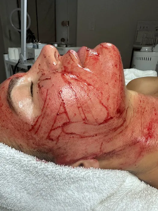 Amy Rojek Skin Care Picture 7