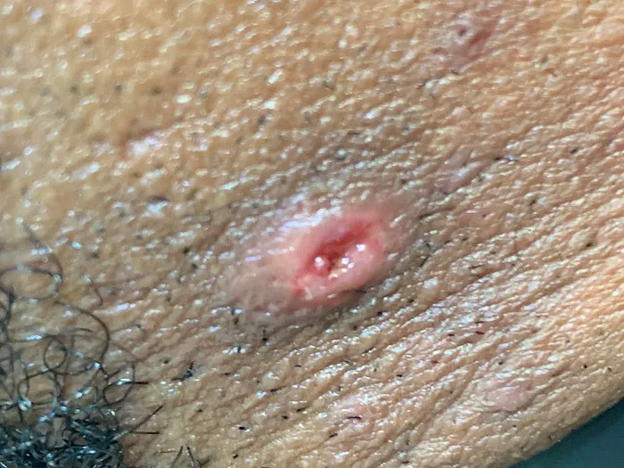 Dr. Barber Chicago Picture 5