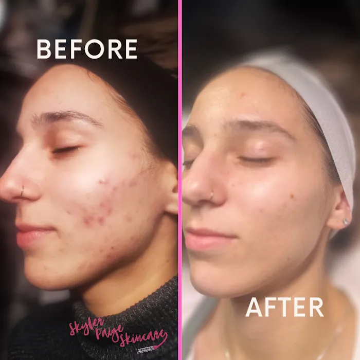 Skyler Paige Skincare Picture 10