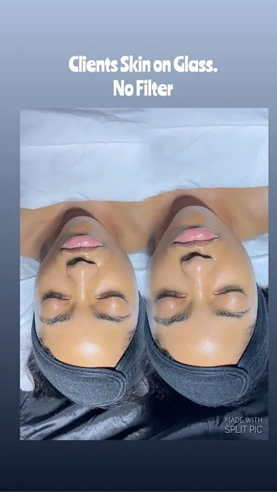 Rich Skin RX Picture 2