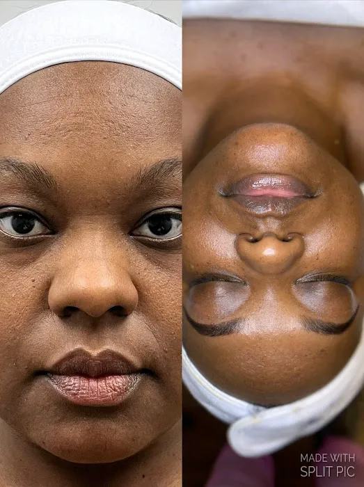 Rich Skin RX Picture 3