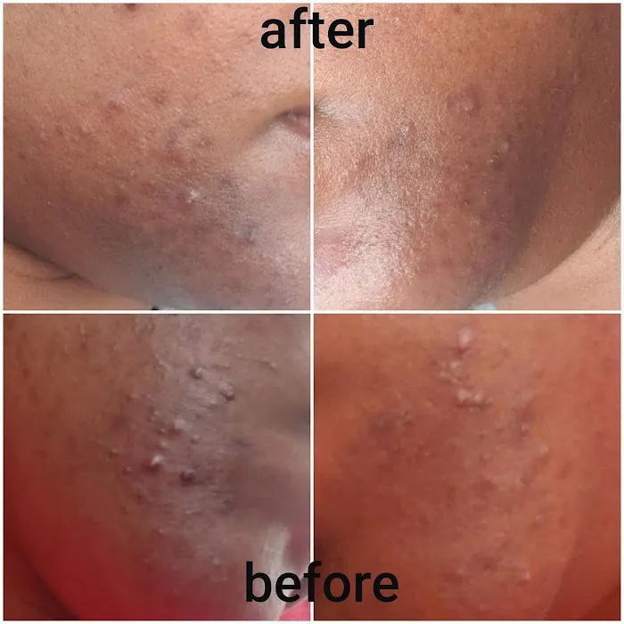 Rich Skin RX Picture 9