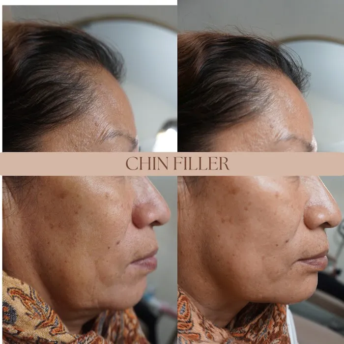 Dose Of Beauty Aesthetics Picture 7