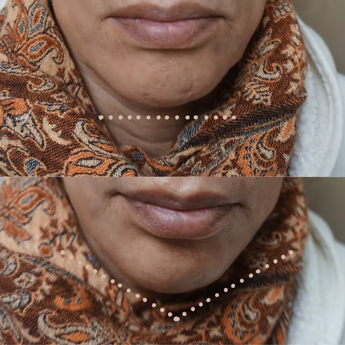 Dose Of Beauty Aesthetics Picture 5