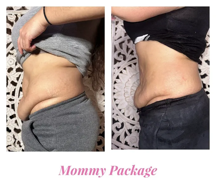 Slim Thicc Body Sculpting Picture 5