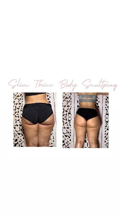 Slim Thicc Body Sculpting Picture 1