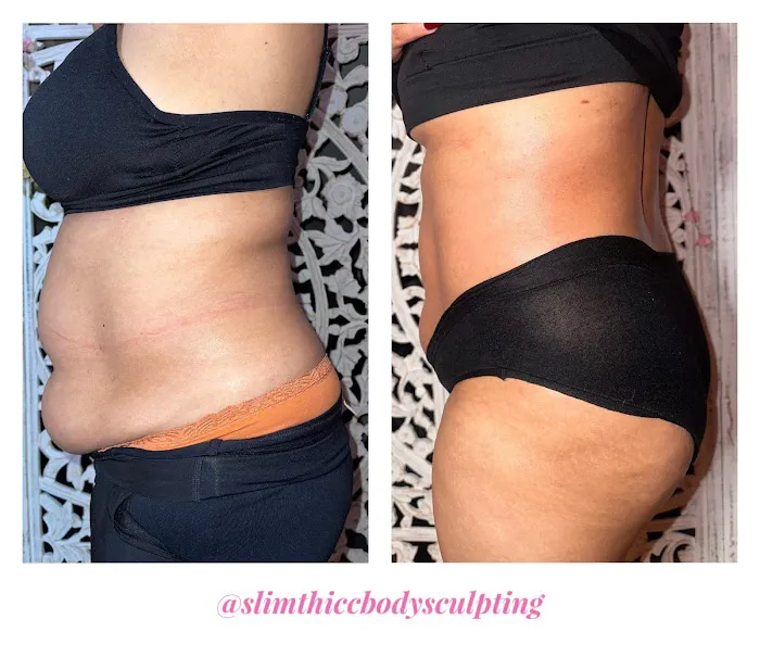 Slim Thicc Body Sculpting Picture 8