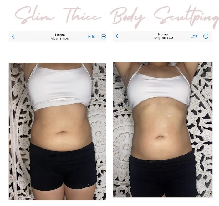 Slim Thicc Body Sculpting Picture 10