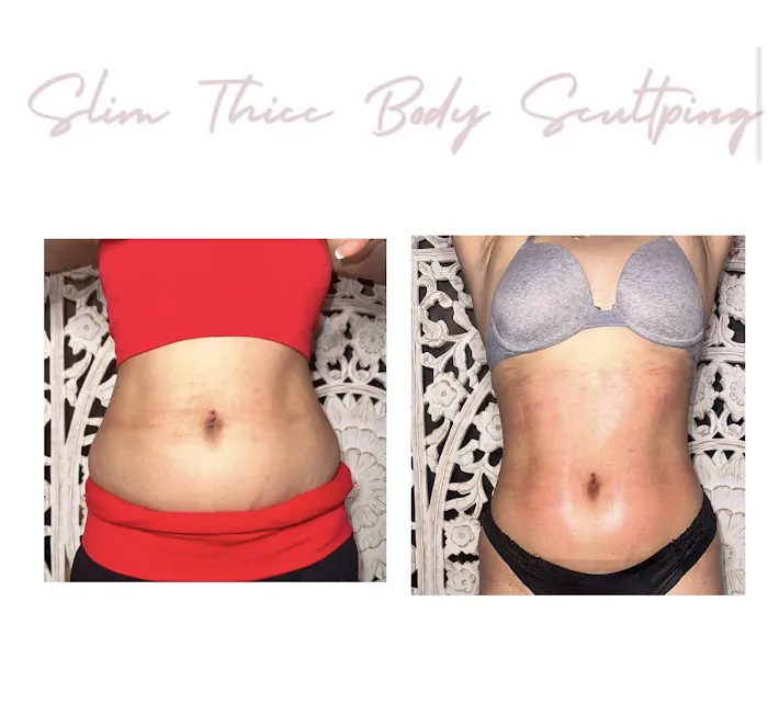 Slim Thicc Body Sculpting Picture 7