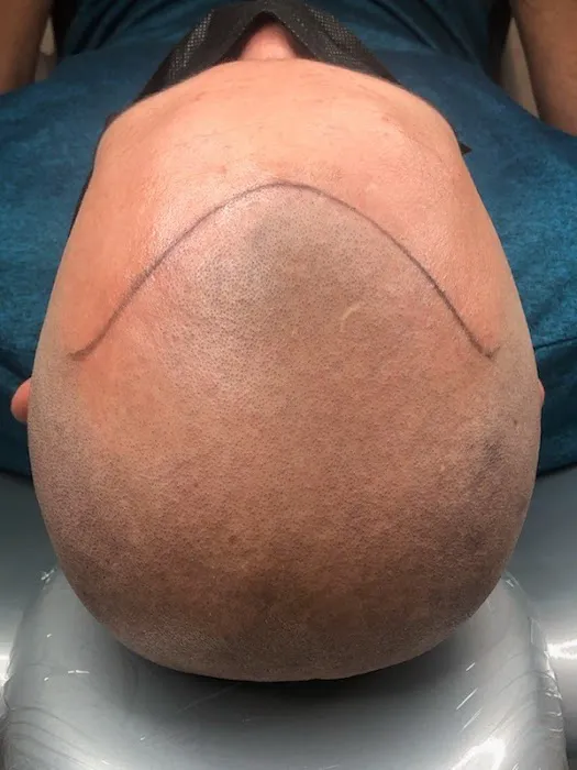 Shy Spot Skin Corrector Picture 4